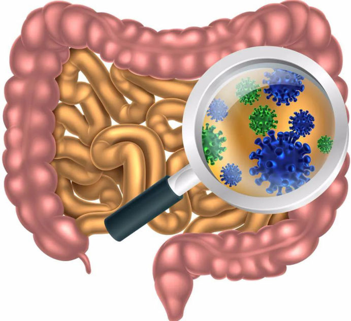 肠,肠道常见的六种疾病