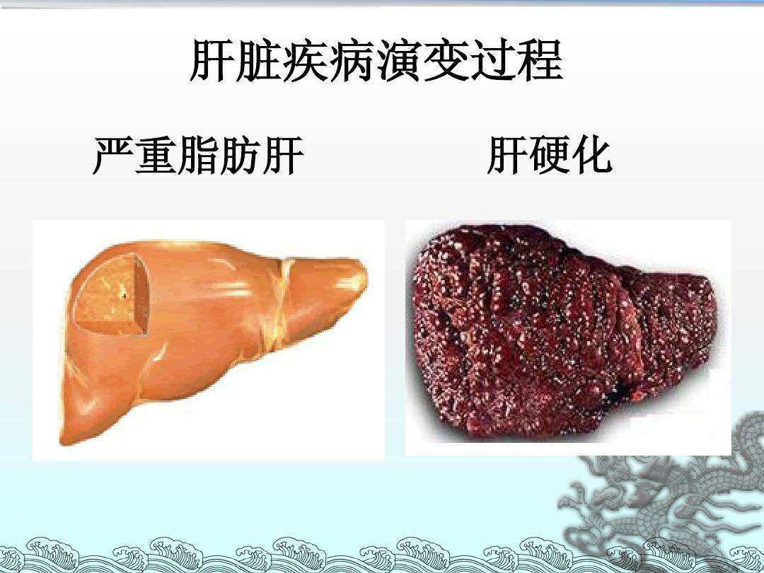 怎么保护肝脏养肝护肝的三种水果