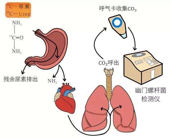 幽门螺旋杆菌的指标范围是多少