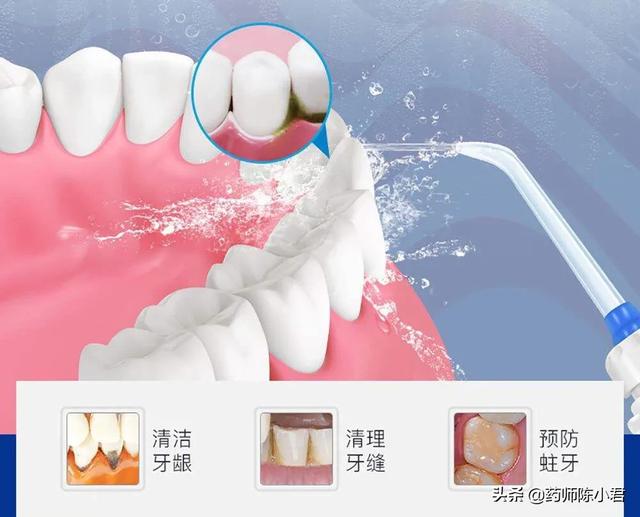 幽门螺旋杆菌阳性可以根治吗