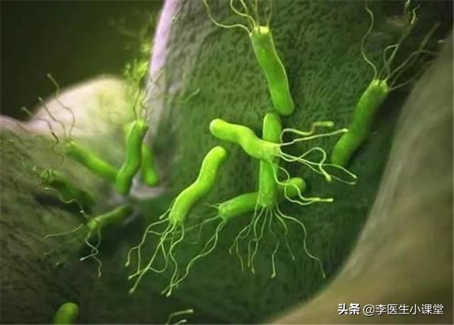 幽门螺旋杆菌感染是怎么引起的