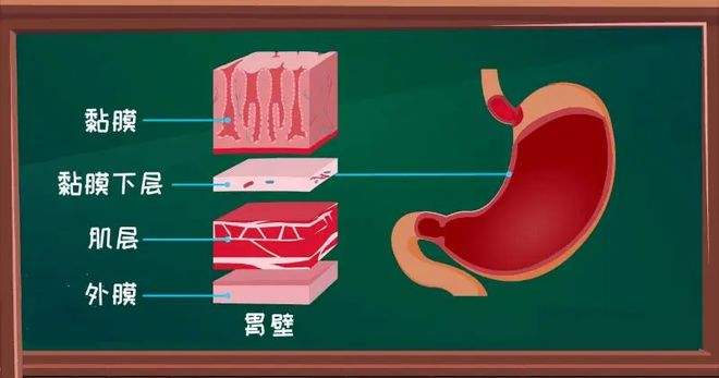 胃穿孔怎么个疼法胃穿孔症状