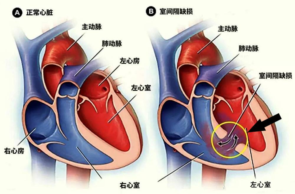 心脏位置心脏正确位置图