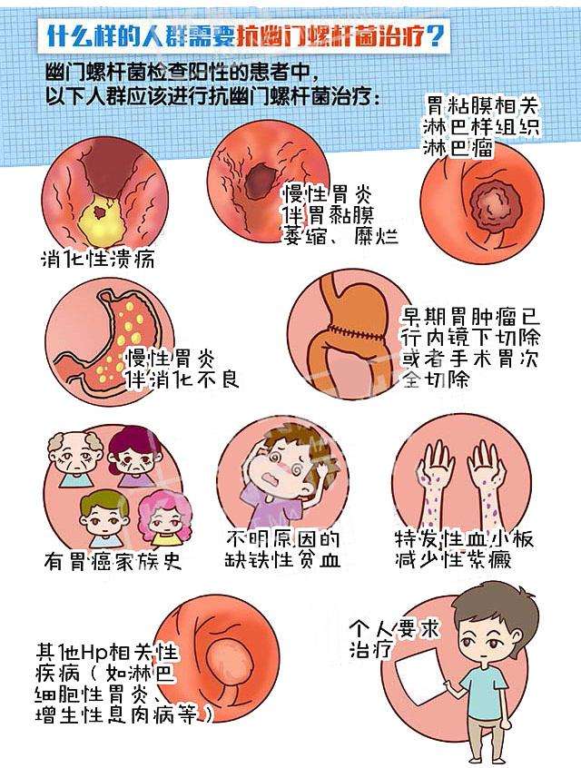 幽门螺旋杆菌是常见病吗,幽门螺旋杆菌是查什么