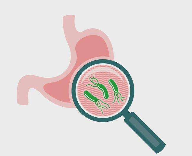 关于幽门螺旋杆菌阳性有哪些症状的信息