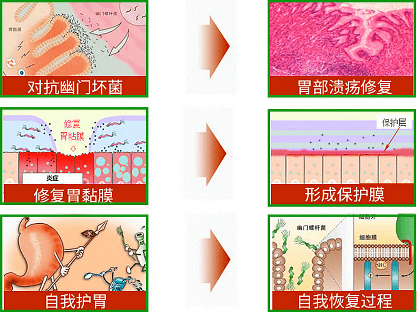 治疗幽门螺杆菌时不能吃什么食物,幽门螺旋杆菌治疗期间饮食禁忌