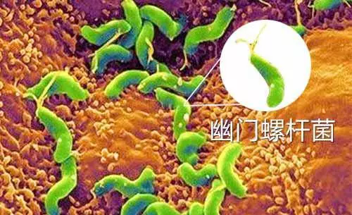 关于幽门螺旋杆菌感染有哪些症状放屁的信息