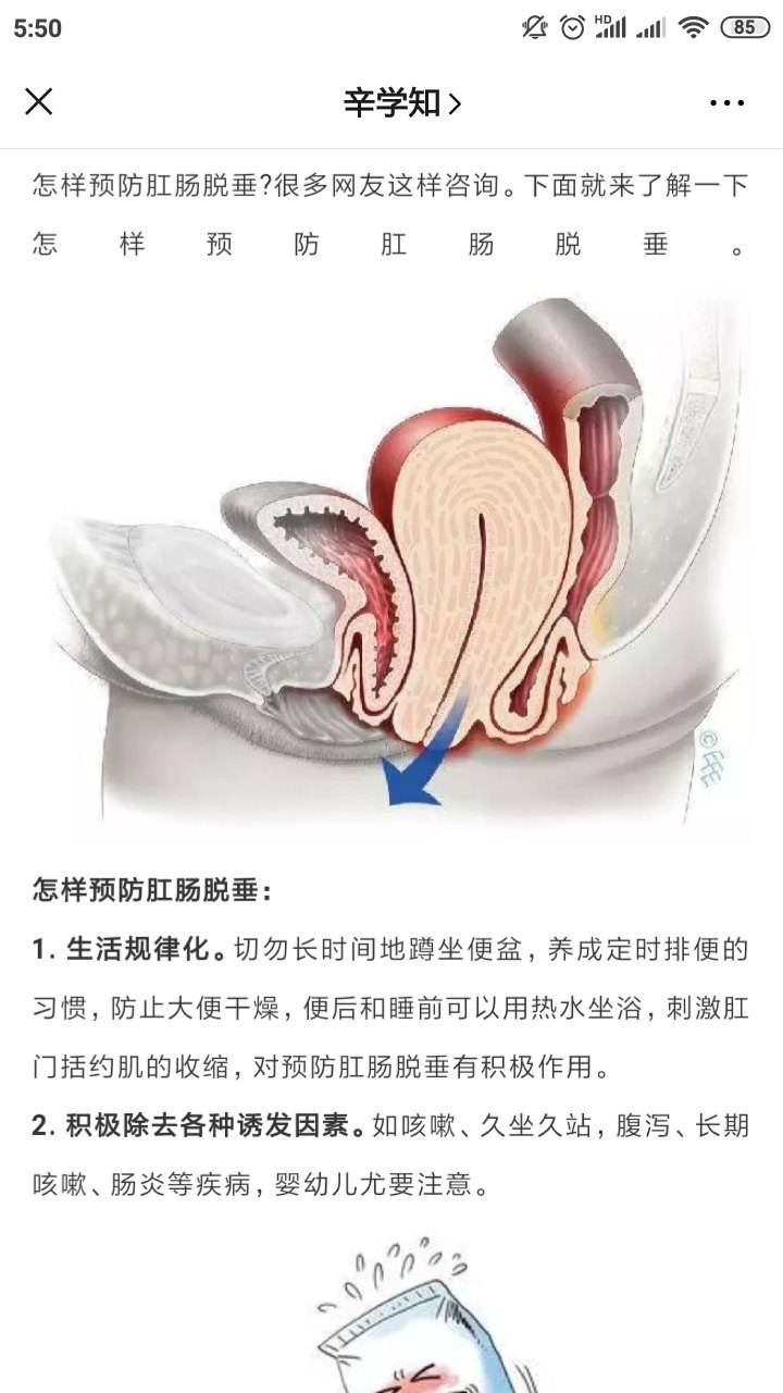 肛门有一块肉凸出来收不回去,直肠脱垂