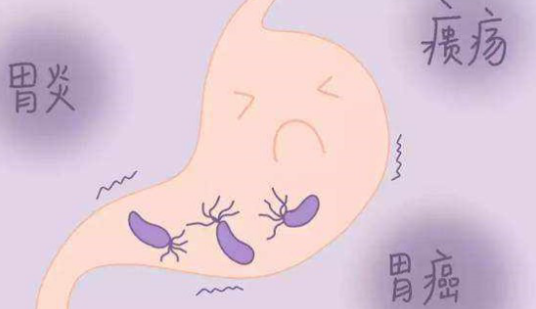 幽门螺旋杆菌怎么引起的的简单介绍