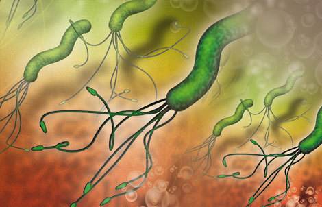 幽门螺旋杆菌怎么传染他人,接吻100%会传染幽门螺旋杆菌吗