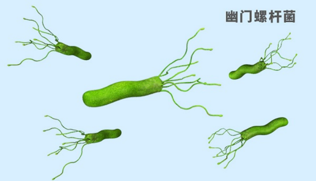 幽门螺旋杆菌阳性代表什么长期口臭一定是幽门螺杆菌吗