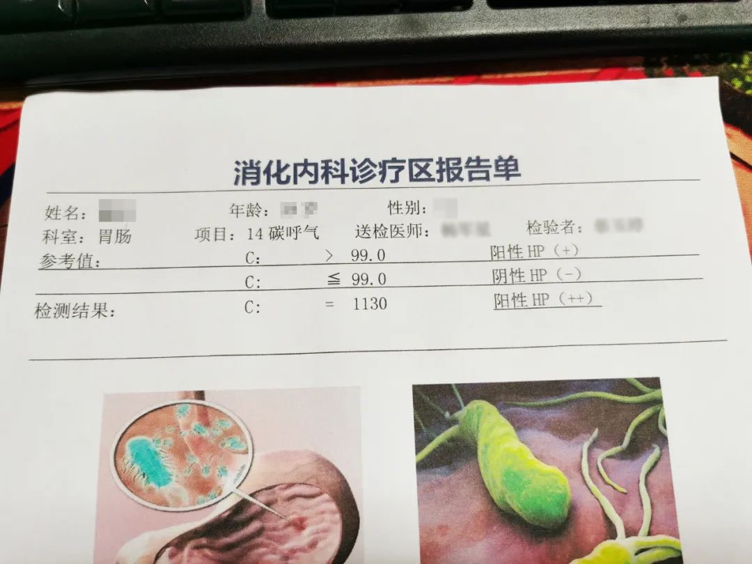 幽门螺杆菌阳性没有症状需要治疗吗幽门螺杆菌弱阳性需要治疗吗