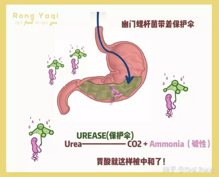 关于幽门螺旋杆菌治疗需要多少钱的信息