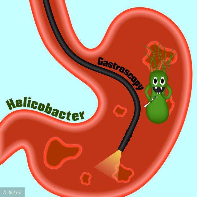 医生不建议查幽门螺旋杆菌吗幽门螺旋杆菌治疗需要多久
