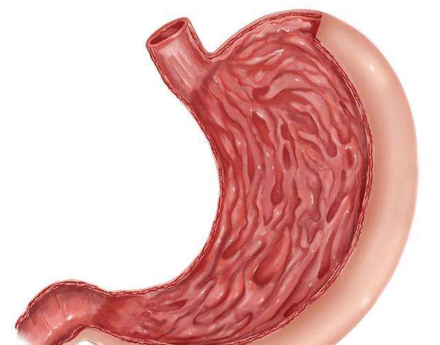 胃在什么位置图片胃在什么位置图片左边还是右边