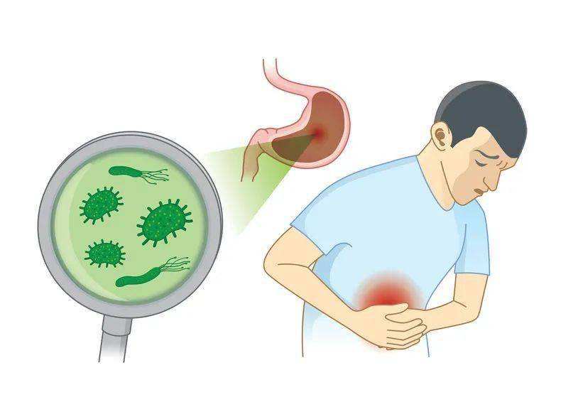 幽门螺杆菌感染有什么症状吃什么药幽门螺旋杆菌感染有哪些症状用药