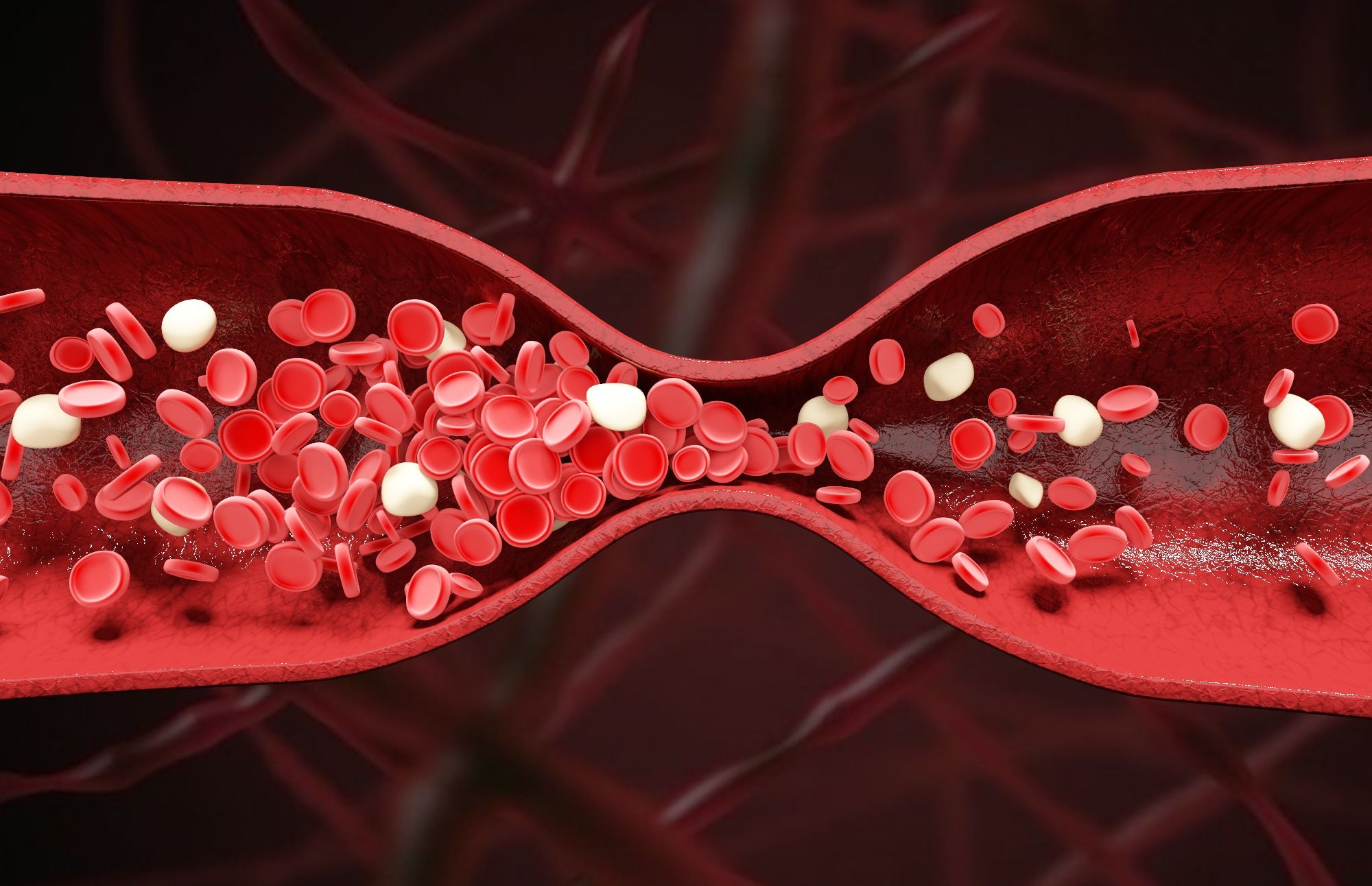 血管瘤是什么引起的血管