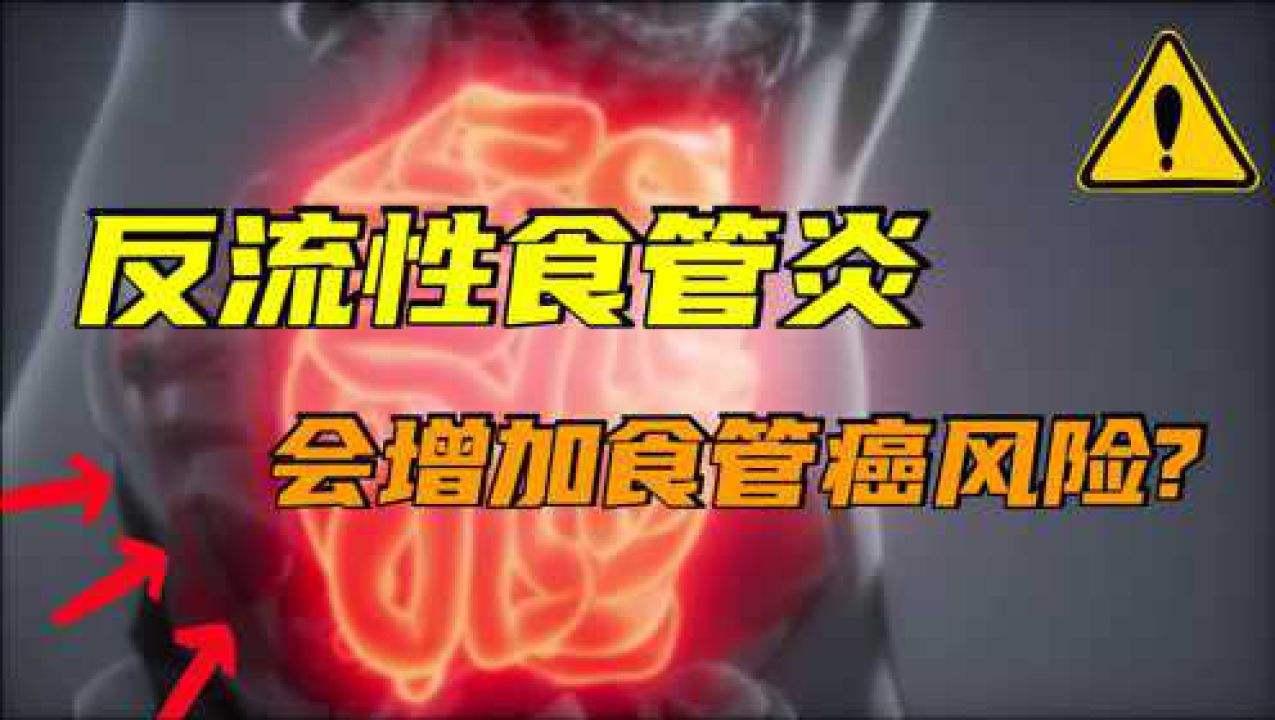 反流食管炎反流食管炎吃啥药好