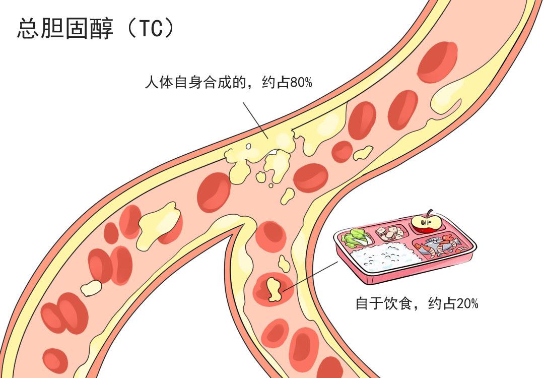 血脂异常是什么原因造成的?,血脂异常