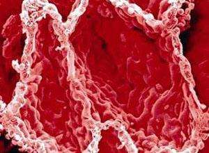 血浆纤维蛋白原测定低怎么回事,血浆纤维蛋白原