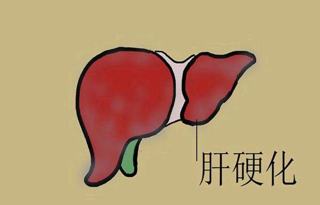 肝脏不好有什么表现症状有哪些女性肝脏不好有什么表现症状有哪些